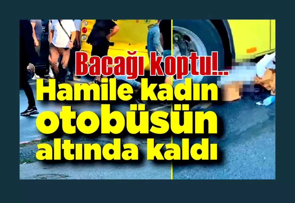 Otobüsün altında kalan hamile kadının bacağı koptu