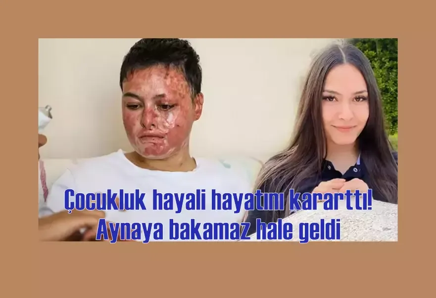 Çocukluk hayali hayatını kararttı! Aynaya bakamaz hale geldi