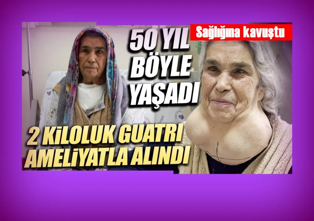 Doktordan korktuğu için yıllarca devasa kitleyle yaşadı