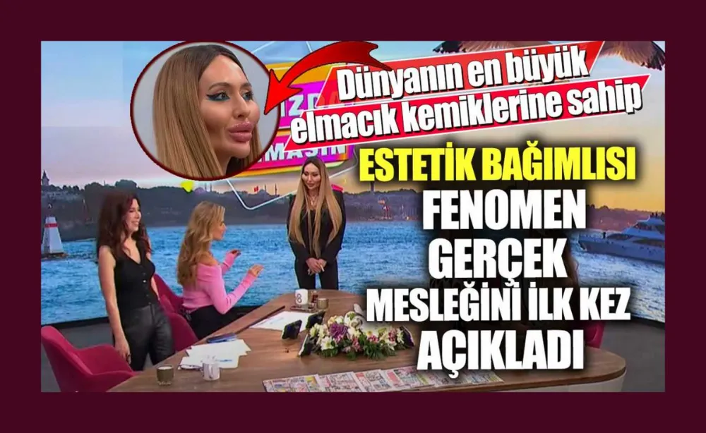 Dünyanın en büyük elmacık kemiklerine sahip! Estetiklerini sayarken kendi bile yoruldu